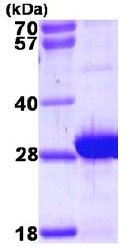 SDS-PAGE - Recombinant Human MLC1SA protein (AB111637), expandable thumbnail