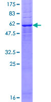 SDS-PAGE - Recombinant Human MLD protein (AB160100), expandable thumbnail