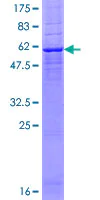SDS-PAGE - Recombinant Human MLD protein (AB160100)