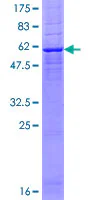 SDS-PAGE - Recombinant Human MLD protein (GST tag N-Terminus) (AB160100)