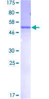 SDS-PAGE - Recombinant Human MLF2 protein (AB159941)