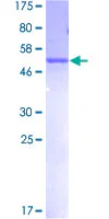 SDS-PAGE - Recombinant Human MLF2 protein (AB159941)