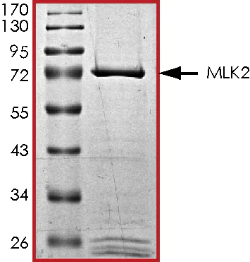 SDS-PAGE - Recombinant human MLK2 protein (AB125562)