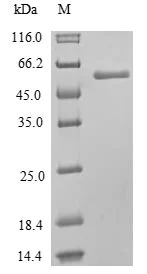 SDS-PAGE - Recombinant Human MLKL protein (His tag) (AB239569)