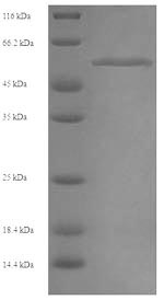 SDS-PAGE - Recombinant Human MLKL protein (His tag) (AB241453)