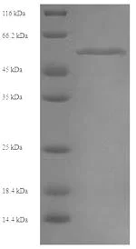 SDS-PAGE - Recombinant Human MLKL protein (His tag) (AB241453)