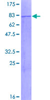SDS-PAGE - Recombinant Human MLYCD/MCD protein (GST tag N-Terminus) (AB161633)