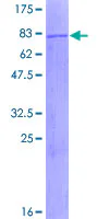 SDS-PAGE - Recombinant Human MLYCD/MCD protein (GST tag N-Terminus) (AB161633)