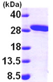 SDS-PAGE - Recombinant Human MMAB protein (His tag N-Terminus) (AB99217)