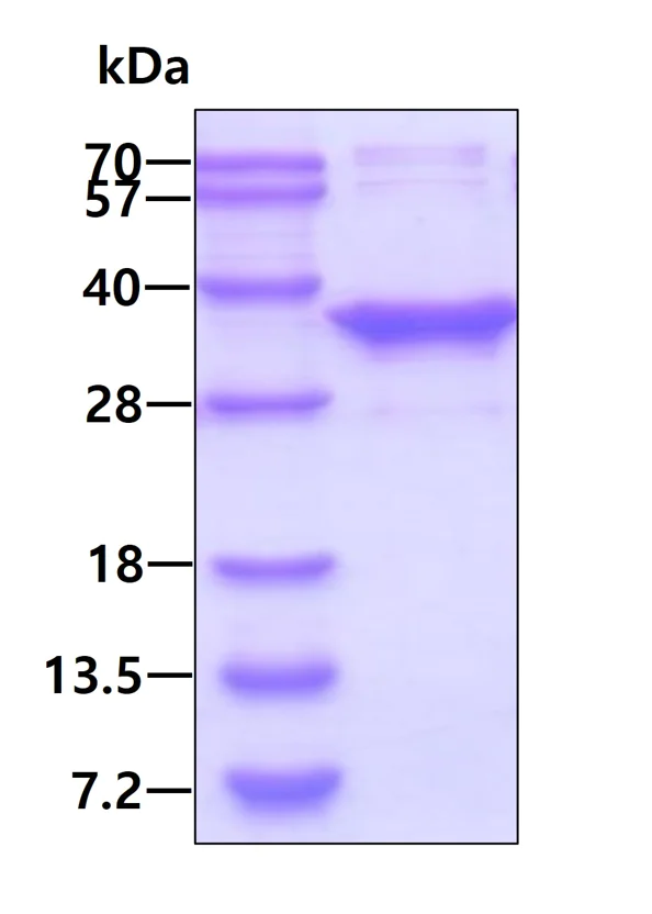 SDS-PAGE - Recombinant Human MMACHC/CblC protein (His tag N-Terminus) (AB126674)