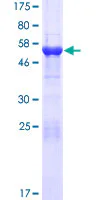 SDS-PAGE - Recombinant Human MMADHC protein (GST tag N-Terminus) (AB162126)