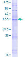 Recombinant Human MMD protein