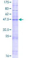 SDS-PAGE - Recombinant Human MMD protein (GST tag N-Terminus) (AB161674)