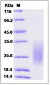 SDS-PAGE - Recombinant Human MMGT1 protein (His tag) (AB276608)