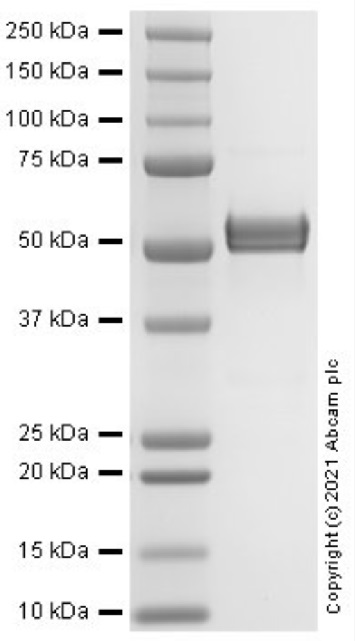 SDS-PAGE - Recombinant Human MMP1 protein (AB283424)