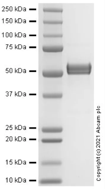 SDS-PAGE - Recombinant Human MMP1 protein (AB283424)