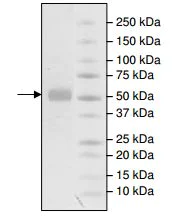 SDS-PAGE - Recombinant human MMP1 protein (Active) (AB198437)