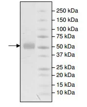 SDS-PAGE - Recombinant human MMP1 protein (Active) (His tag C-Terminus) (AB198437)