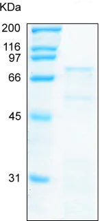 SDS-PAGE - Recombinant Human MMP11 protein (AB92861)