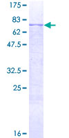 Recombinant Human MMP12 protein