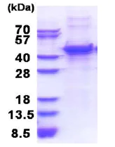 SDS-PAGE - Recombinant Human MMP13 protein (His tag N-Terminus) (AB177626)