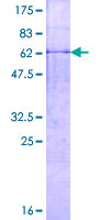 Recombinant Human MMP23 protein