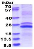 SDS-PAGE - Recombinant Human MMP23 protein (denatured) (His tag N-Terminus) (AB180279)