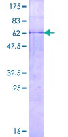 SDS-PAGE - Recombinant Human MMP23 protein (GST tag N-Terminus) (AB160066)