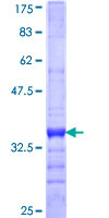 SDS-PAGE - Recombinant Human MMP28 protein (AB153506), expandable thumbnail
