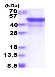SDS-PAGE - Recombinant Human MMP28 protein (denatured) (AB177646), expandable thumbnail