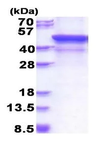 SDS-PAGE - Recombinant Human MMP28 protein (denatured) (His tag N-Terminus) (AB177646)