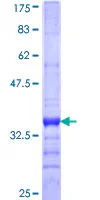 SDS-PAGE - Recombinant Human MMP28 protein (GST tag N-Terminus) (AB153506)