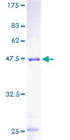 SDS-PAGE - Recombinant Human MMP6/MPP6 protein (GST tag N-Terminus) (AB160871)