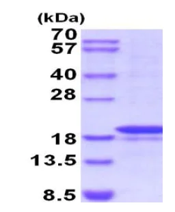 SDS-PAGE - Recombinant Human MMP7 protein (denatured) (Tag Free) (AB202248)