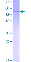 Recombinant Human MMP8 protein
