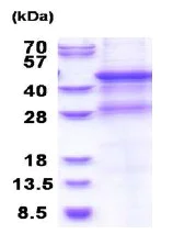 SDS-PAGE - Recombinant Human MMP8 protein (denatured) (AB177636)