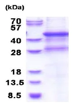 SDS-PAGE - Recombinant Human MMP8 protein (denatured) (His tag N-Terminus) (AB177636)