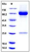 SDS-PAGE - Recombinant Human MMP8 protein (His tag) (AB276235)