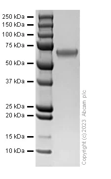 SDS-PAGE - Recombinant Human MMP9 Protein (His tag) (AB310787)