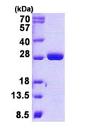 SDS-PAGE - Recombinant Human MOB4A protein (AB140717), expandable thumbnail
