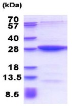 SDS-PAGE - Recombinant Human MOBKL2B protein (AB177639), expandable thumbnail