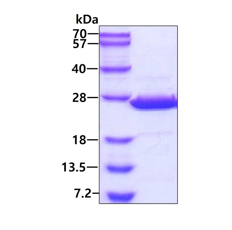 SDS-PAGE - Recombinant Human MOG1 protein (His tag N-Terminus) (AB130051)