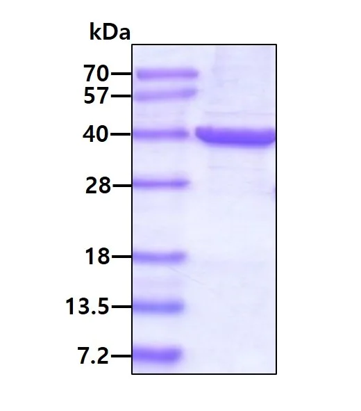 SDS-PAGE - Recombinant Human Monoacylglycerol Lipase/MGL protein (AB101045)