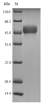 SDS-PAGE - Recombinant Human MORC3 protein (Tagged) (AB225648)