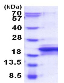 Recombinant Human MOSPD1 protein
