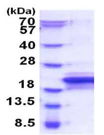 SDS-PAGE - Recombinant Human MOSPD1 protein (His tag N-Terminus) (AB187410)