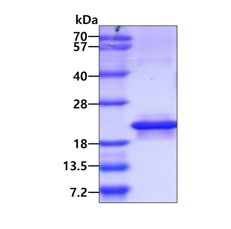 SDS-PAGE - Recombinant Human MOSPD1 protein (His tag N-Terminus) (AB187410)