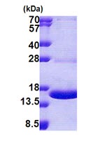 SDS-PAGE - Recombinant Human MPZL protein (AB167917), expandable thumbnail