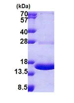 SDS-PAGE - Recombinant Human MPZL protein (His tag N-Terminus) (AB167917)