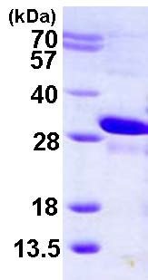 SDS-PAGE - Recombinant Human MRas protein (His tag N-Terminus) (AB123181)